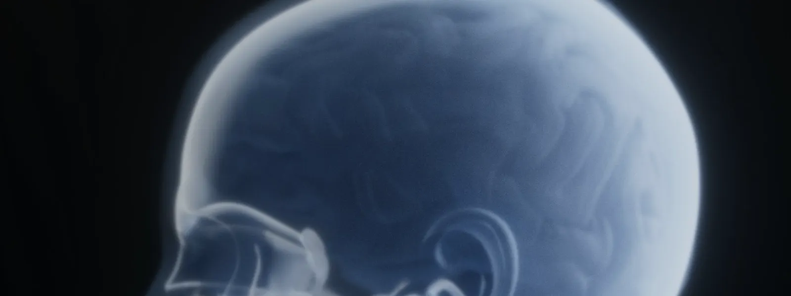 X-ray of the skull and cervical spine