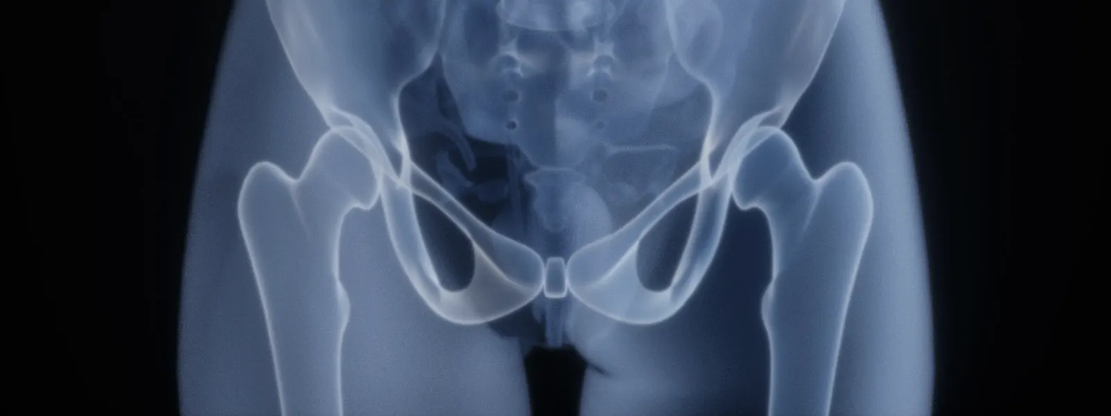 X-ray of the lumbar spine and pelvis