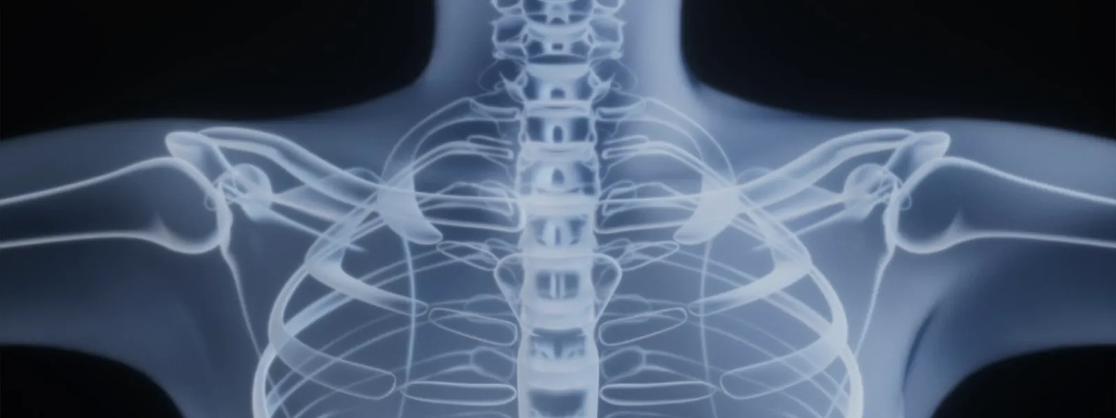 X-ray of the upper spine and shoulders