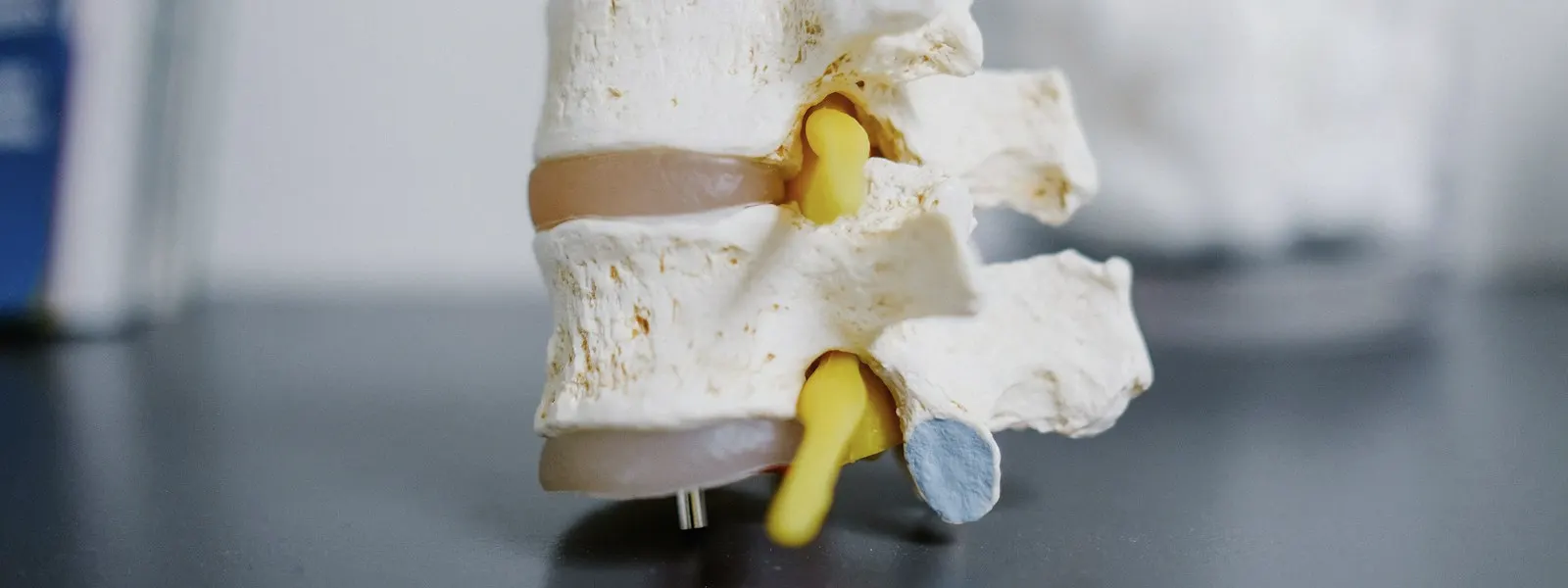 Anatomical model of lumbar vertebrae
